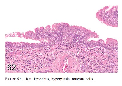 fig62.jpg