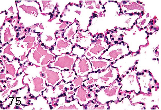 fig75.jpg