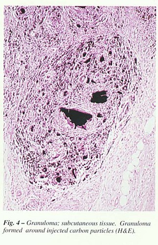 Fig34.jpg
