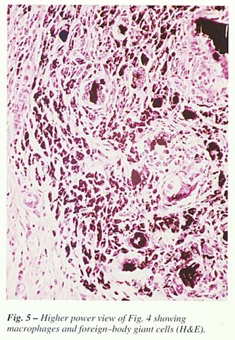 Fig35.jpg