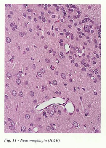 fig11.jpg