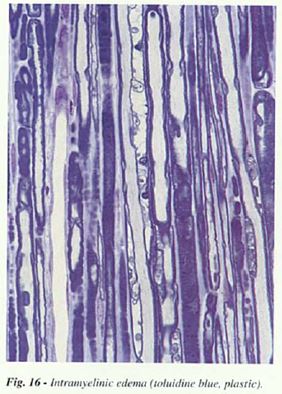 fig16.JPG