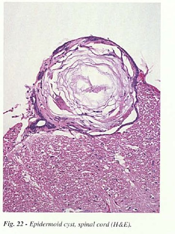 fig22.jpg