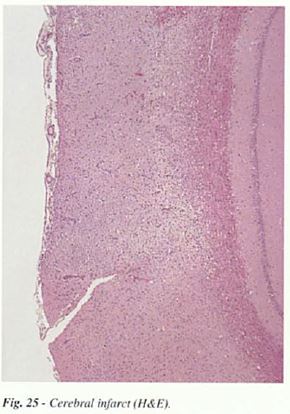 fig25.JPG