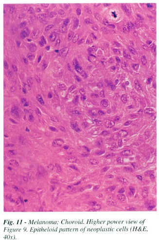 fig11.jpg