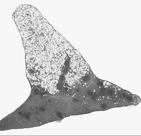 Figure 7 lipidosis.bmp