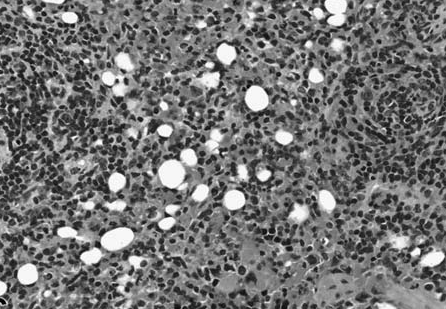 Figure 8 vacuolation.bmp