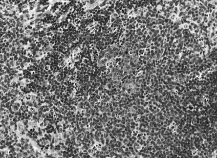 FIgure 11 opoptosis.bmp