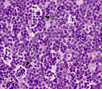 Figure 1 decreased cellularity thymus (final).bmp