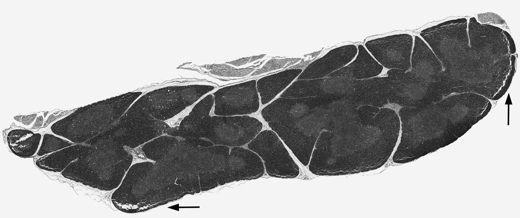 Figure 2 thymus ratio of cortex and medulla 1 2.bmp